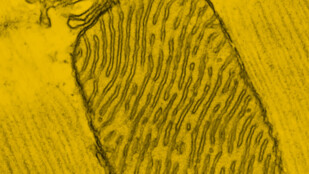 Czarno-żółte zdjęcie. Zbliżenie na komórkę pod mikroskopem.