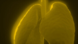Czarno-żółte zdjęcie płuc.