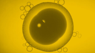 Czarno żółta grafika komórki